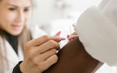 Microneedling Acupuncture vs. Traditional Microneedling