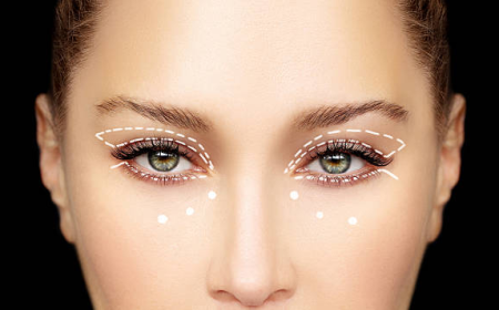 Blepharoplasty Dubai | Eyelid Surgery Guide