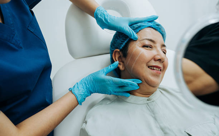 How Vector Facelift in Dubai Helps Lift Sagging Facial Skin