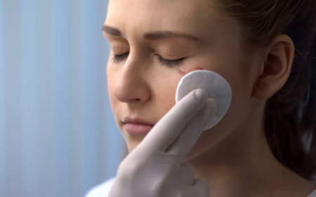Facial Scar Revision in Dubai | Complete Guide