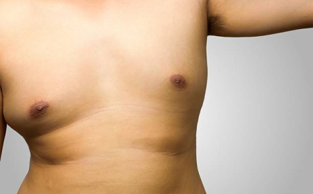 Vaser Quad Liposuction in Dubai | Body Contouring