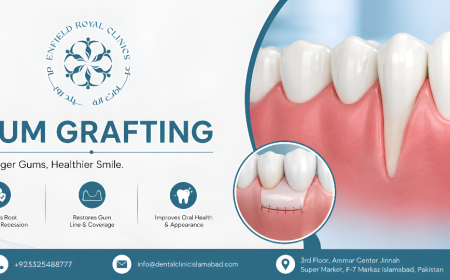 Gum Grafting in Islamabad for Improved Smile Aesthetics