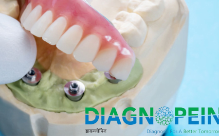 Best Dental Clinic In Mumbai | Expert Dental Implant Specialists