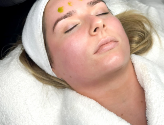 Biorepeel In Manchester – Reveal Smoother, Brighter, Refreshed-Looking Skin