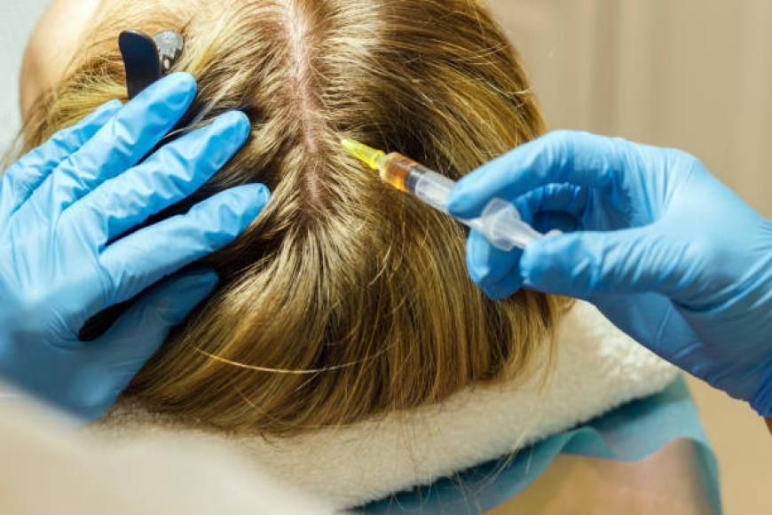 Exosome Hair in Dubai: How It Restores Hair Naturally