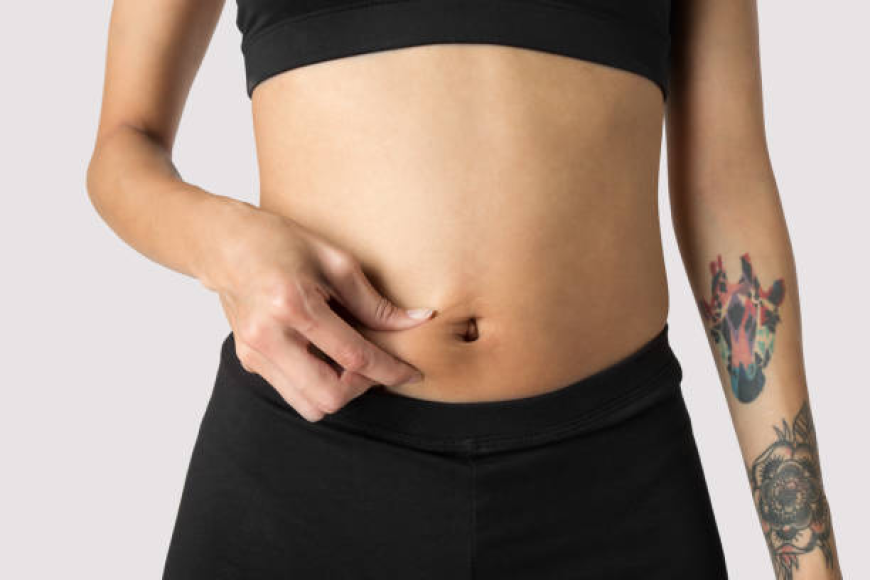 Tummy Tuck in Dubai After Weight Loss Transformation