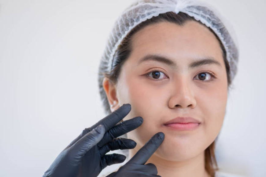 Is Buccal Fat Removal in Dubai Right for You