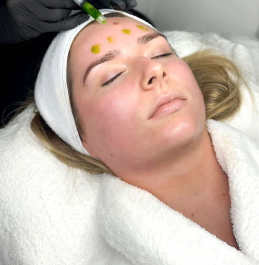 Biorepeel In Manchester – Innovative Chemical Peel Treatment for Fresh and Radiant Skin