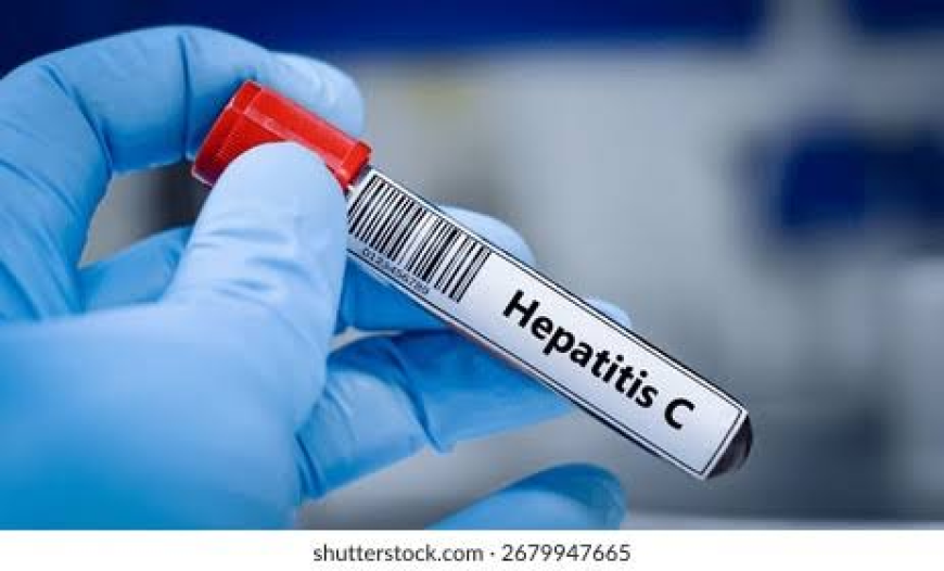 Hepatitis B and C Test Price in Lahore | Reliable Liver Health Screening