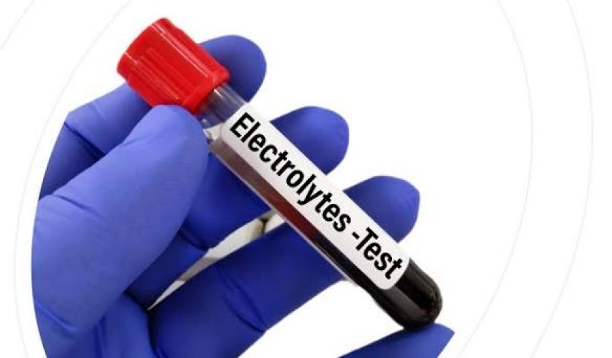 What Determines the Electrolyte Test Price