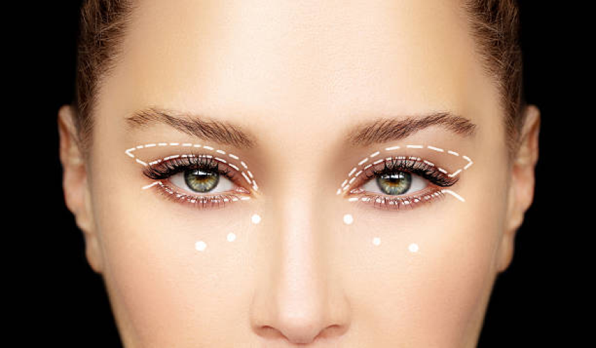 Blepharoplasty Dubai | Eyelid Surgery Guide