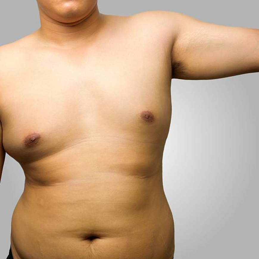 Vaser Quad Liposuction in Dubai | Body Contouring