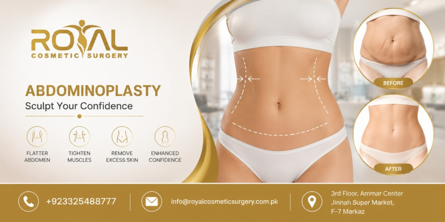 Abdominoplasty in Islamabad for Timeless Confidence
