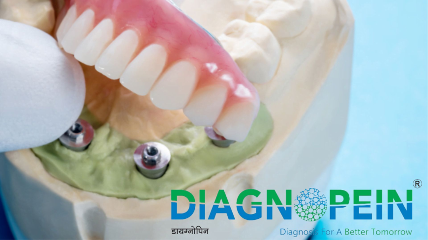 Best Dental Clinic In Mumbai | Expert Dental Implant Specialists