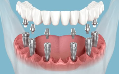 Dental Clinic in Mumbai with Skilled Dentists for Quality Smile Care