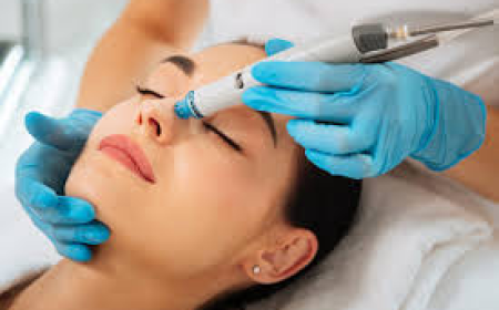 Laser Facial Delhi for Clear, Smooth and Glowing Skin
