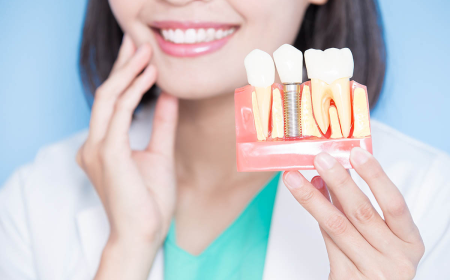 Dental Implants in Islamabad: A Personalized Path Toward Better Oral Health and Confidence