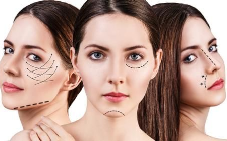 What Makes a Facelift Surgery Procedure in Delhi Personalized?