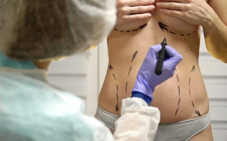 Liposuction in Islamabad: Beyond Measurements, Discovering the Philosophy of Body Sculpting