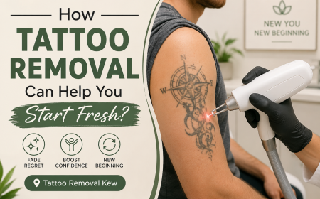 How Tattoo Removal Can Help You Start Fresh?
