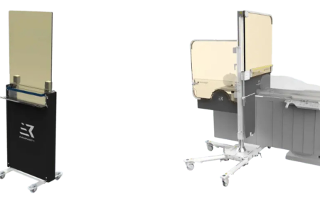 What Sets a Trusted Angiography Device Supplier Apart in Healthcare