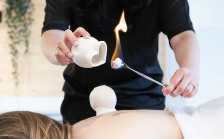 What Is Cupping Therapy and How Does It Work? A Complete Guide to Natural Healing