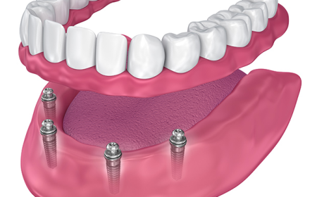 How to Compare Dental Family Insurance Plans for Your Needs