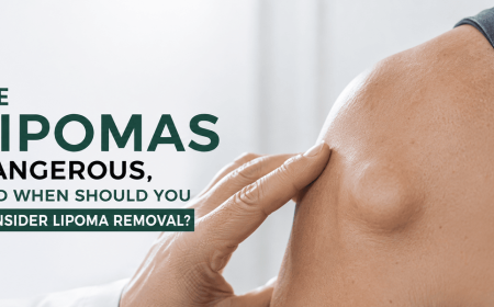 Are Lipomas Dangerous and When Should You Remove Them?