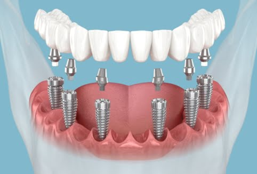 Dental Clinic in Mumbai with Skilled Dentists for Quality Smile Care
