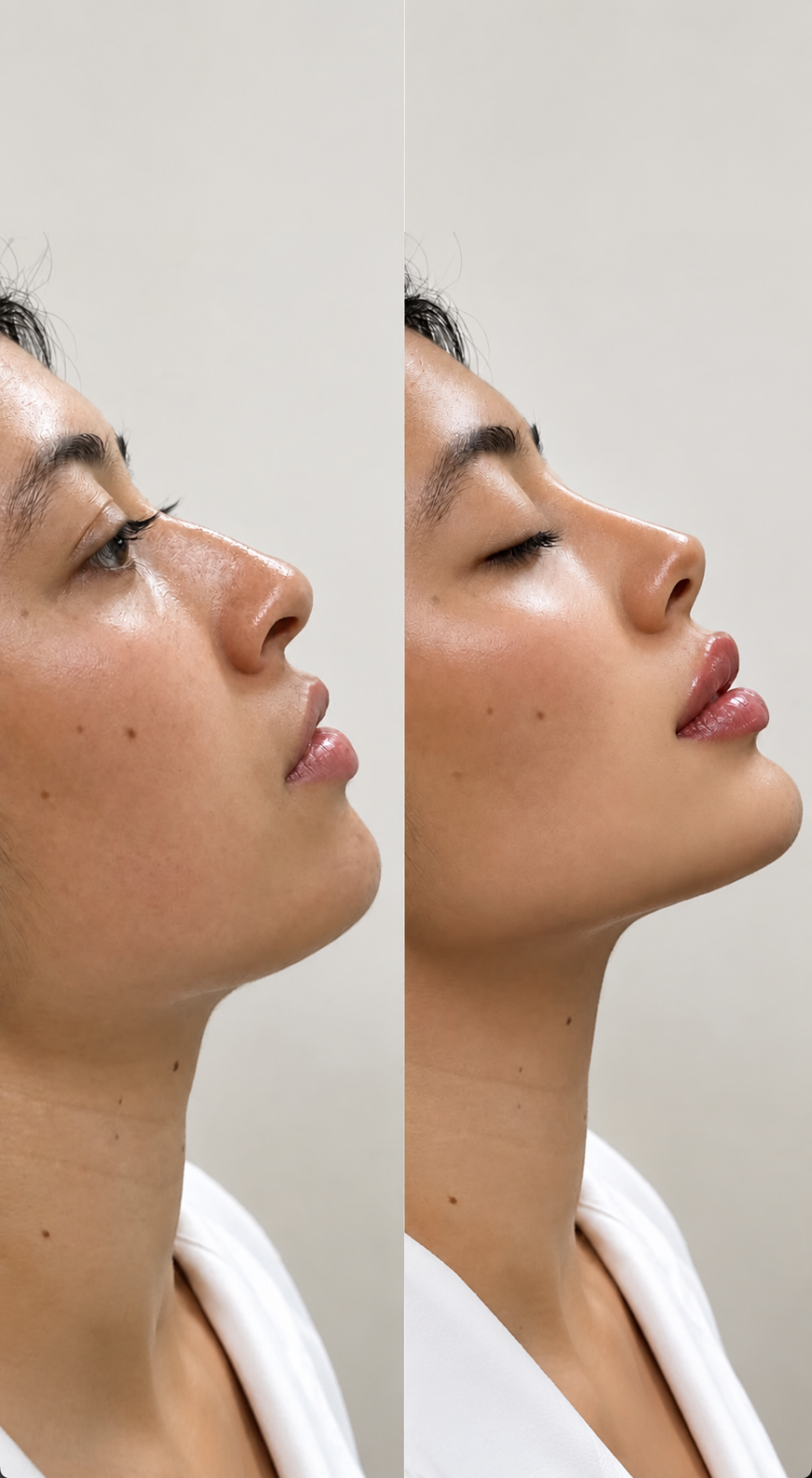 Rhinoplasty in Islamabad: How Modern Facial Concepts Are Redefining Nose Aesthetics