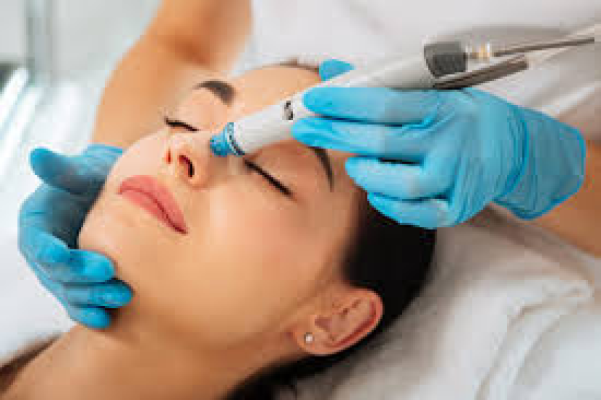 Laser Facial Delhi for Clear, Smooth and Glowing Skin