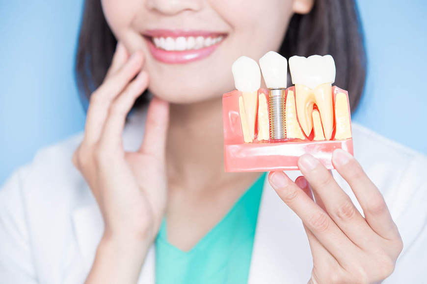 Dental Implants in Islamabad: A Personalized Path Toward Better Oral Health and Confidence