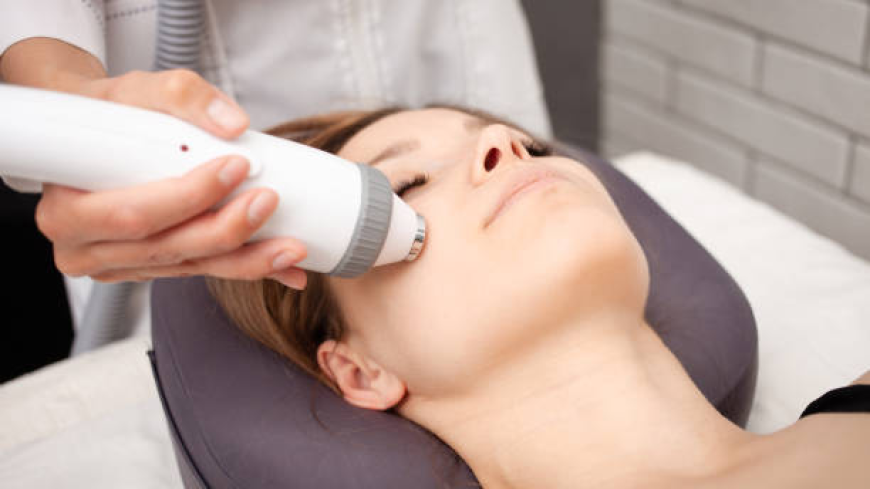 Can Microneedling Help With Acne Scars and Uneven Skin Texture?