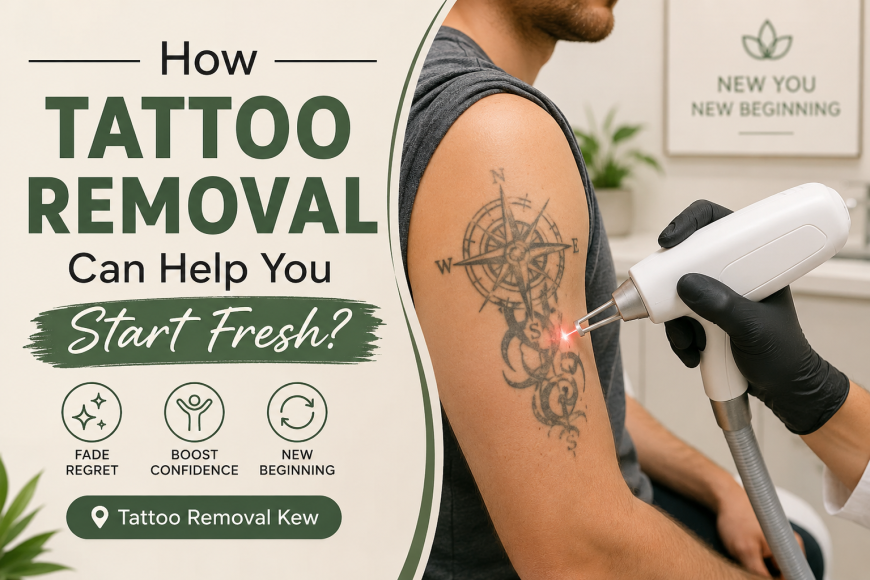 How Tattoo Removal Can Help You Start Fresh?