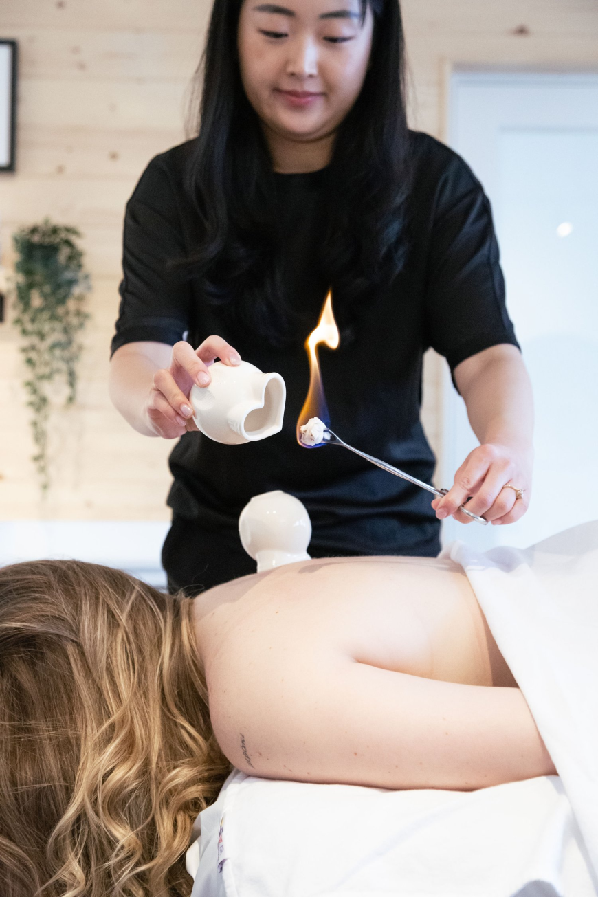 What Is Cupping Therapy and How Does It Work? A Complete Guide to Natural Healing