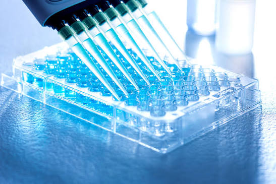 ELISA Assays for Disease Biomarker Detection in Clinical Research
