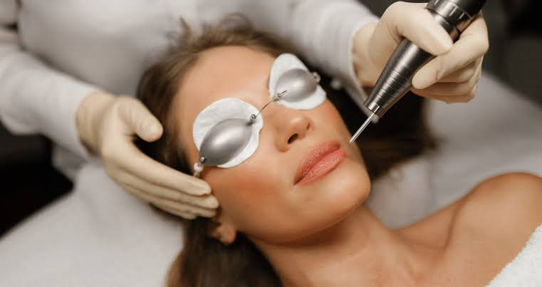 Laser Treatment for Pigmentation: Can It Remove Dark Spots Permanently?