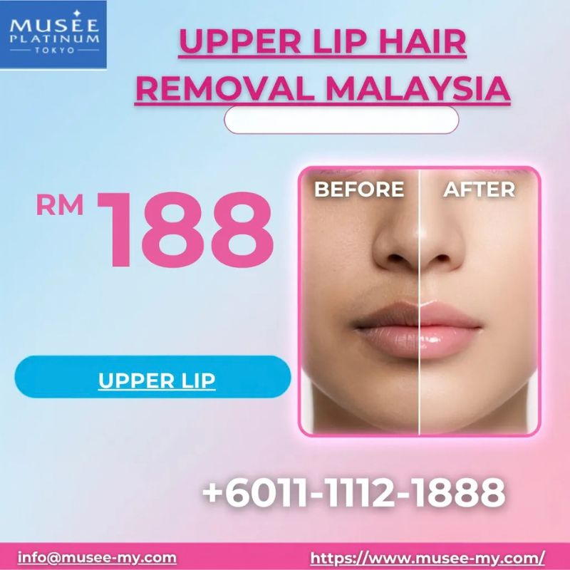 Upper Lip Hair Removal Malaysia: Safe and Effective Solutions for Smooth, Confident Skin