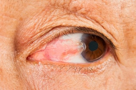  Harley Vision Laser Eye Clinic  Follow LASIK Eye Surgery Price UK, and What You Should Really Expect to Pay