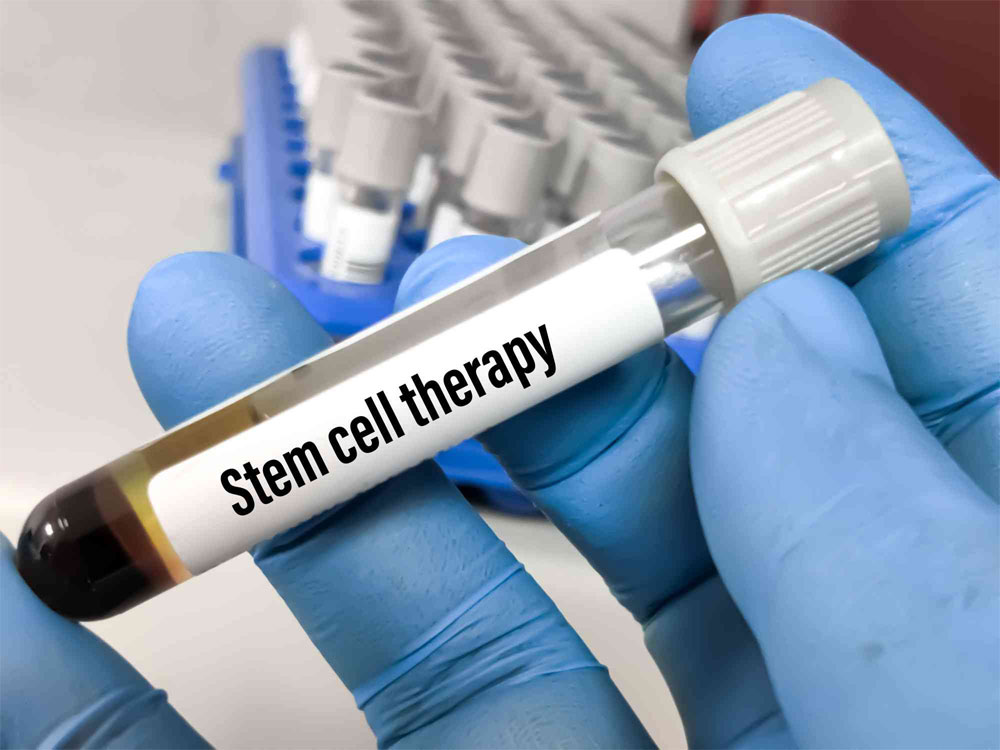 Regenerative Care in India: Understanding Stem Cells, PRP, Exosomes and Sports Recovery