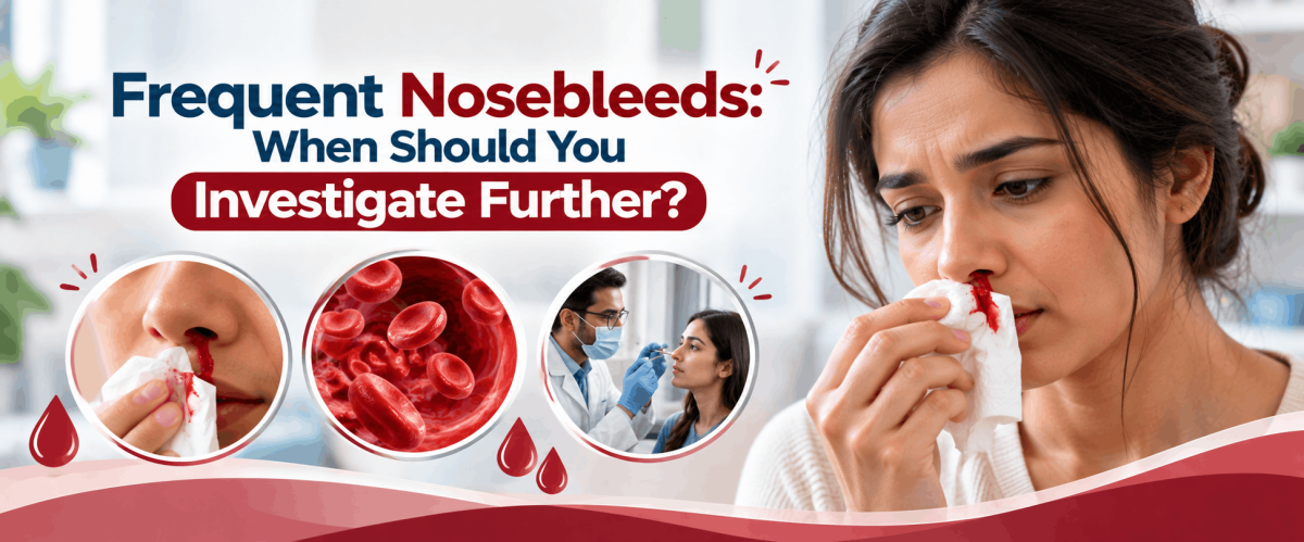 Frequent Nosebleeds: When Should You Investigate Further?