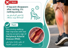 Supportive Care with Varicose Veins Stockings