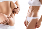 Liposuction Surgery in Dubai What to Expect Before During and After the Procedure