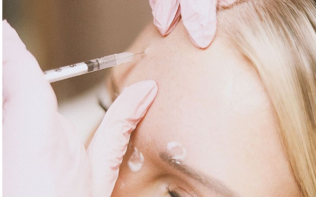The Most Popular Areas Treated With Dermal Fillers