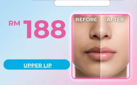 Upper Lip Hair Removal Malaysia: Safe and Effective Solutions for Smooth, Confident Skin