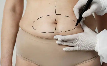 Tummy Tuck in Dubai After Pregnancy: Can Abdominoplasty Restore Your Abdomen?