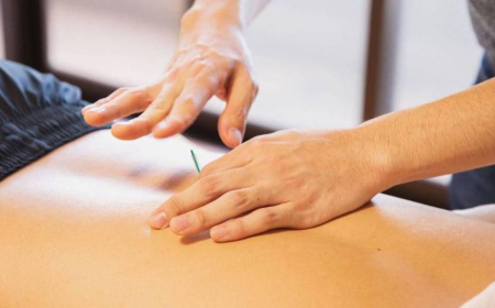 Acupuncture for Orthopedic Pain: 5 Myths | Oakland