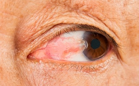  Harley Vision Laser Eye Clinic  Follow LASIK Eye Surgery Price UK, and What You Should Really Expect to Pay