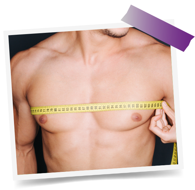 Gynaecomastia Surgery in Dubai: Recovery Guide