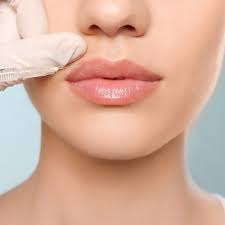 How Tajmeels Clinic Helps Patients Set Realistic Expectations for Filler Results